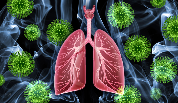 bảo vệ phổi khỏi virus